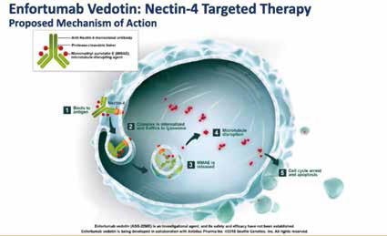 局部晚期或转移性尿路上皮癌 Enfortumab vedotin后线治疗安全有效