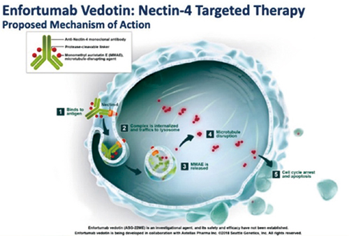 经治的晚期尿路上皮癌 Enfortumab vedotin 对比标准化疗可延长生存