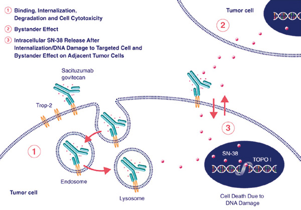 后线治疗mUC Sacituzumab govitecan或安全有效
