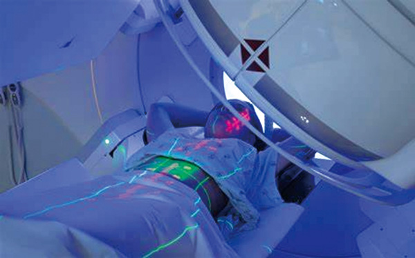 早期NSCLC 不连续SBRT显著改善局部控制和总生存